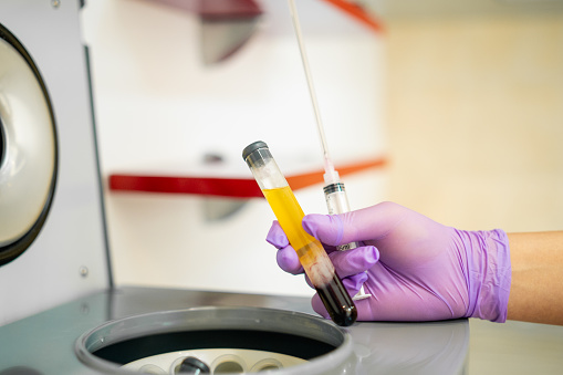 Human hand holding a tube with blood plasma above the centrifuge.