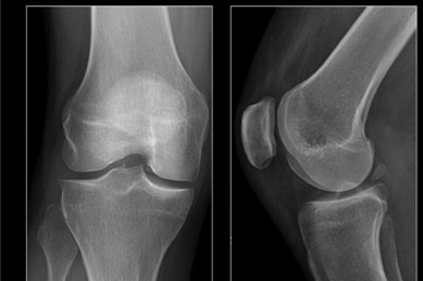 Do I Really Need to Get an X-Ray or MRI? Do I Really Need to Get an X-Ray or MRI?