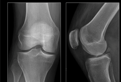 Do I Really Need To Get An X-ray Or Mri? - Arizona Orthopedic Physical 