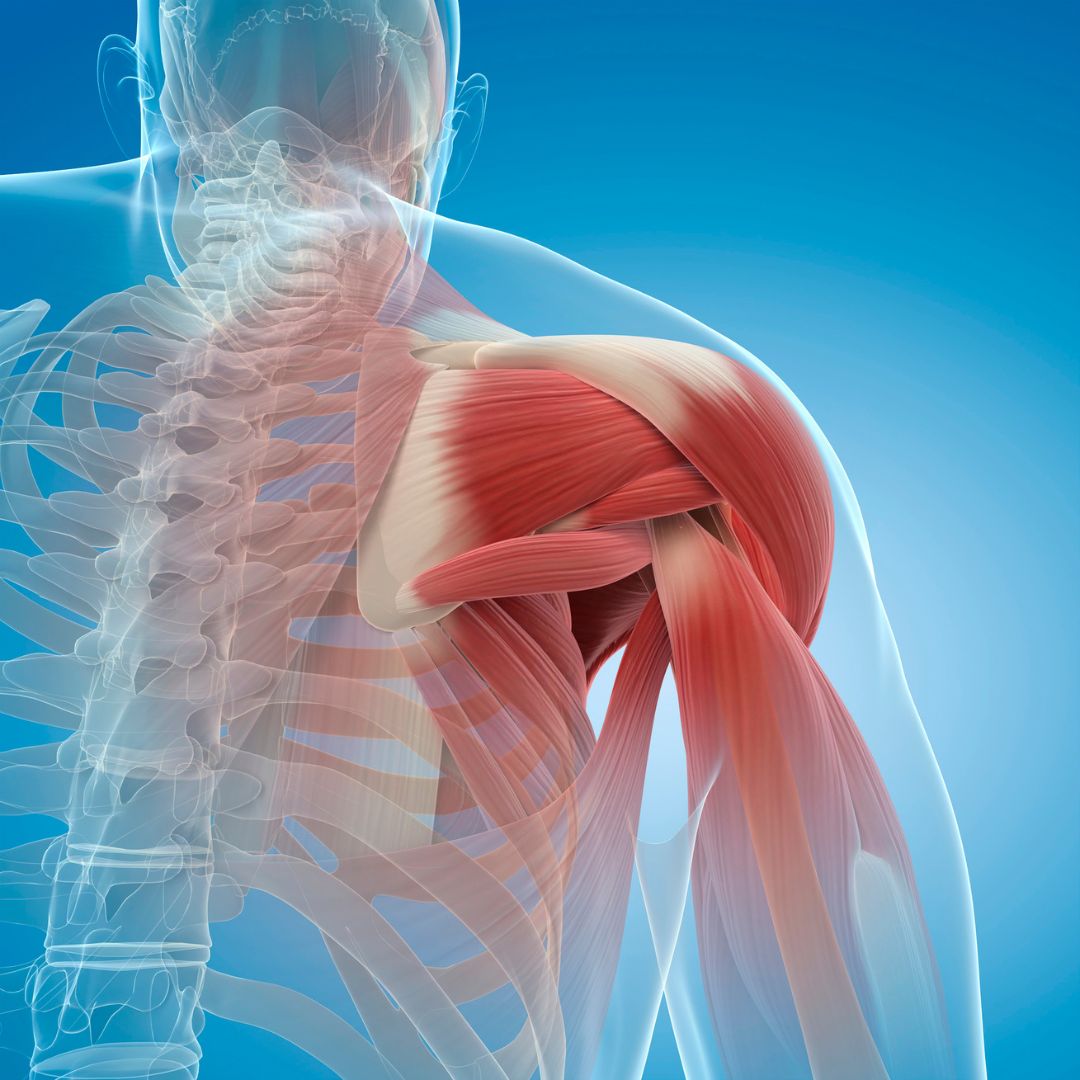 rotator cuff shoulder pain